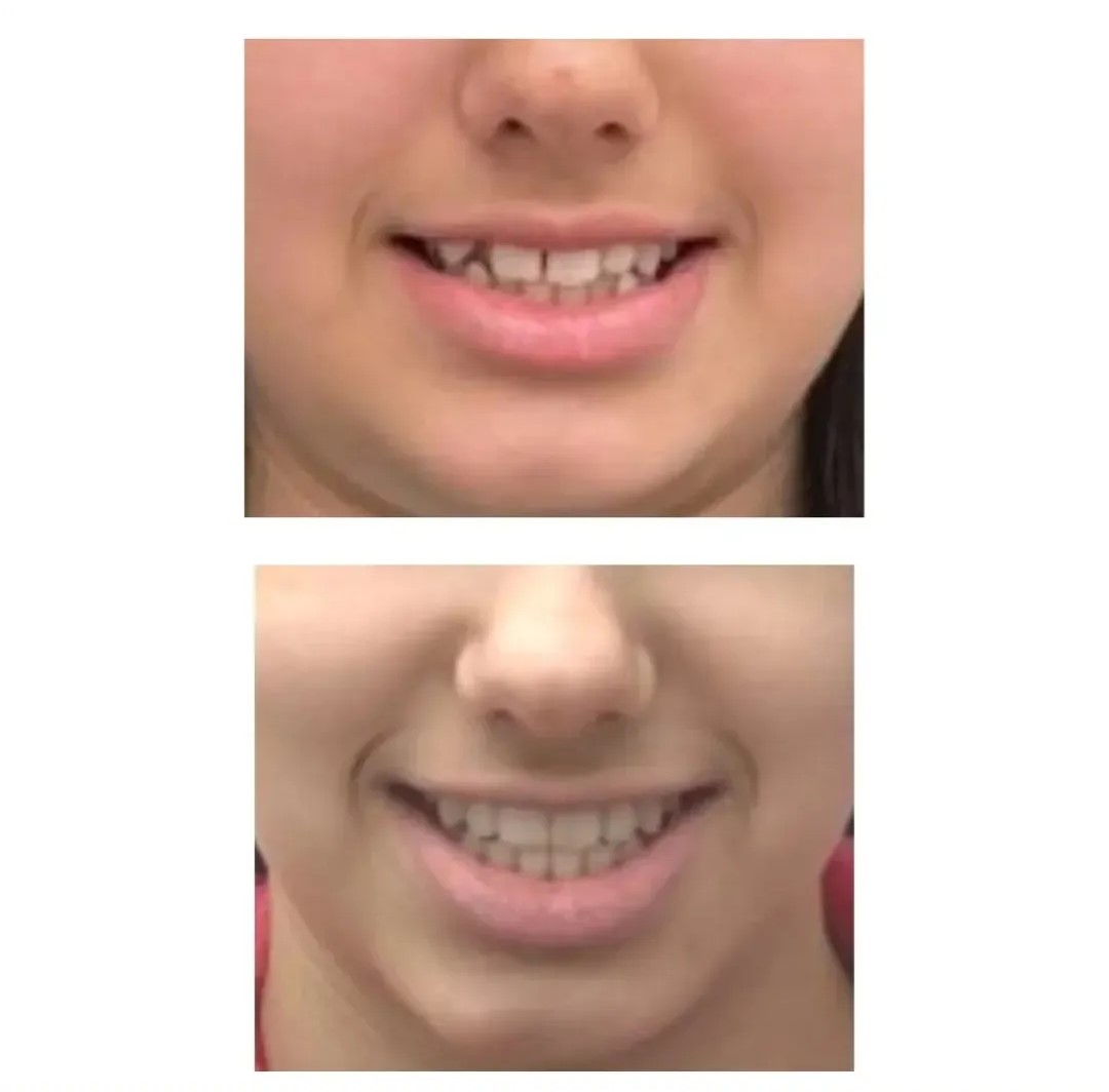 Gal-mg